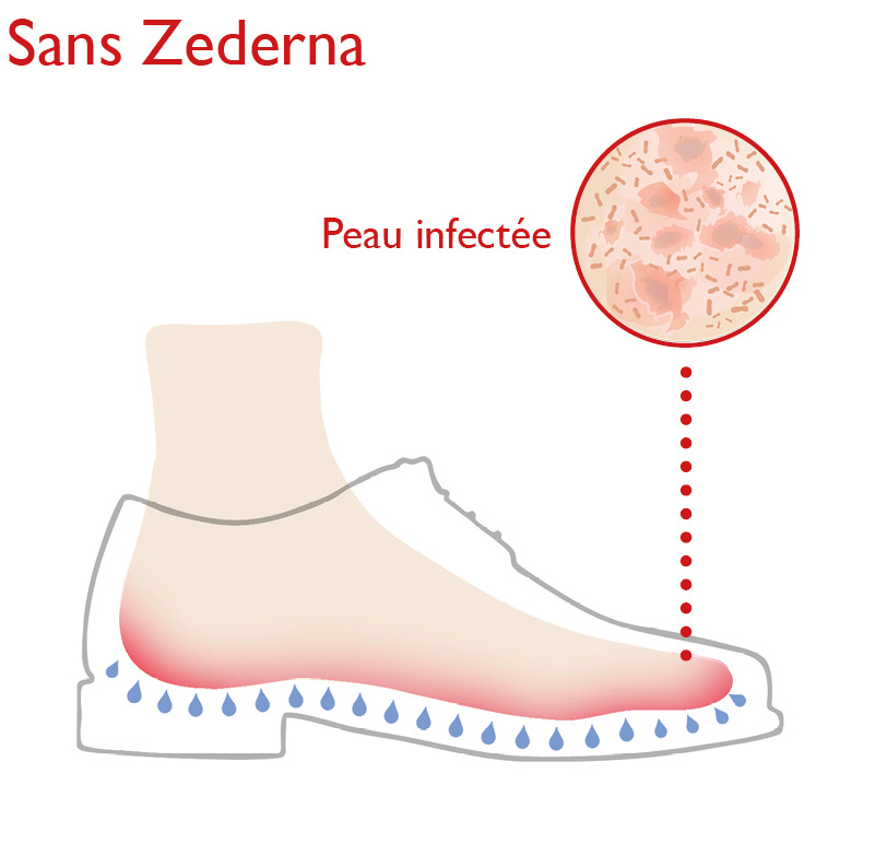 La peau saine et plus de mauvaises odeurs de pieds avec les semelles en cèdre
